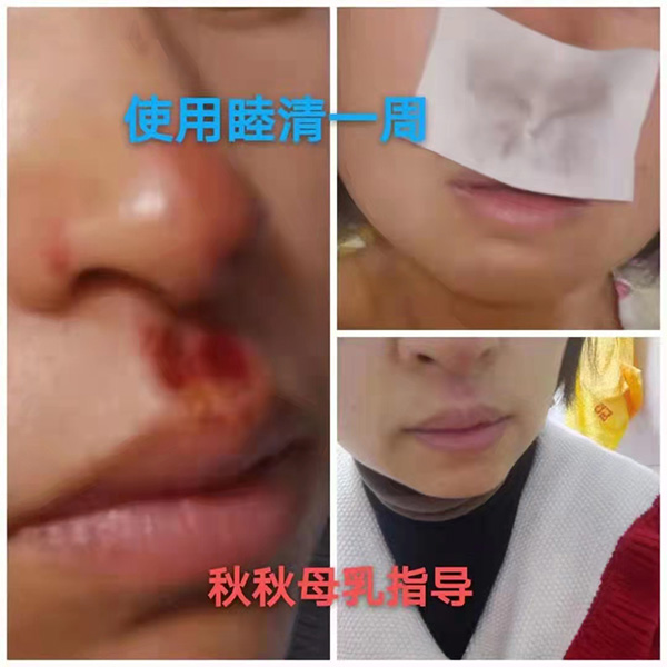 �����澏���N���Æ������M(f��i)�߿ڱ���������(sh��)���a(ch��n)ƷȦ�۟o(w��)��(sh��)