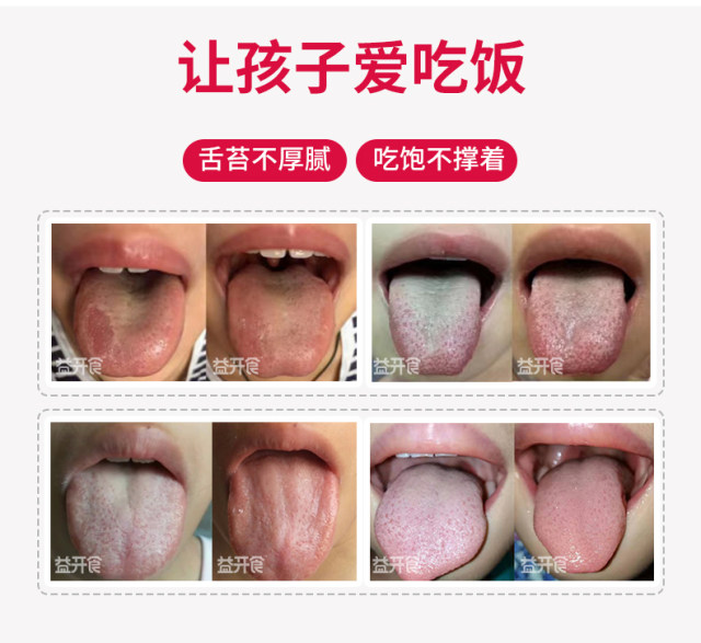 益開食雞內(nèi)金山楂六物膏 (2).jpg